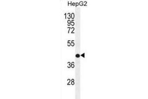 Western Blotting (WB) image for anti-Retinol Dehydrogenase 13 (All-Trans and 9-Cis) (RDH13) antibody (ABIN2996498) (RDH13 antibody)