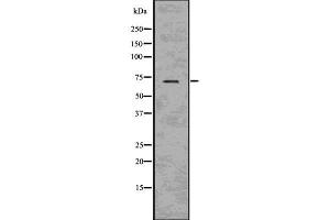 Western blot analysis of BACE using HeLa whole cell lysates (BACE1 antibody  (C-Term))