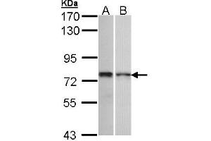Western Blotting (WB) image for anti-Zinc Finger Protein 398 (ZNF398) (AA 358-630) antibody (ABIN467495) (ZNF398 antibody  (AA 358-630))