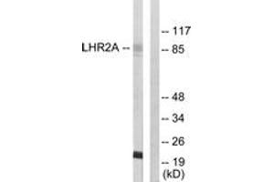 Western blot analysis of extracts from 293 cells, using LHR2A Antibody. (VWA5A antibody  (AA 371-420))