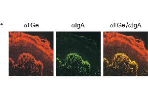 Immunofluorescence image of TGe staining in cryosection of human Skin of dermatitis herpetiformis patient. (TGM3 antibody)