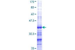 Image no. 1 for Putative Homeodomain Transcription Factor 1 (PHTF1) (AA 248-347) protein (GST tag) (ABIN1314951)