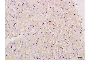 Formalin-fixed and paraffin embedded mouse myocardium labeled with Anti-Myoglobin Polyclonal Antibody, Unconjugated  at 1:200 followed by conjugation to the secondary antibody and DAB staining. (Myoglobin antibody  (AA 21-120))