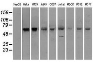 Image no. 2 for anti-Premelanosome Protein (PMEL) antibody (ABIN1500301) (Melanoma gp100 antibody)