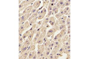 (ABIN391619 and ABIN2841538) staining ANXA2 in Human liver tissue sections by Immunohistochemistry (IHC-P - paraformaldehyde-fixed, paraffin-embedded sections). (Annexin A2 antibody  (N-Term))