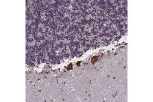 Immunohistochemical staining of human cerebellum with KCNE1L polyclonal antibody  shows strong cytoplasmic positivity in purkinje cells.
