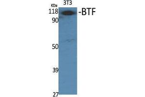 Western Blot (WB) analysis of specific cells using BTF Polyclonal Antibody. (BCLAF1 antibody  (Internal Region))