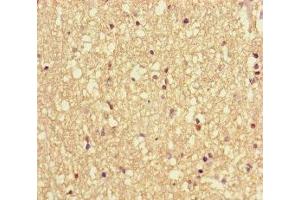 Immunohistochemistry of paraffin-embedded human brain tissue using ABIN7175471 at dilution of 1:100 (VAMP1 antibody  (AA 1-96))