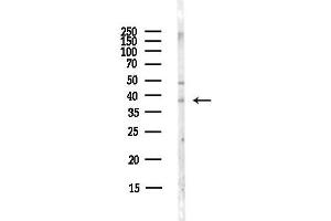 anti-Oxoglutarate (Alpha-Ketoglutarate) Receptor 1 (OXGR1) (Internal Region) antibody