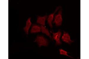 ABIN6267259 staining SK-OV3 by IF/ICC. (EGFR antibody  (pThr693))
