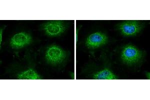 ICC/IF Image LARS2 antibody [N2C1], Internal detects LARS2 protein at mitochondria by immunofluorescent analysis. (LARS2 antibody)