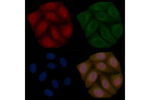 STAT1 Mouse Monoclonal Antibody staining Hela cells by IF/ICC.