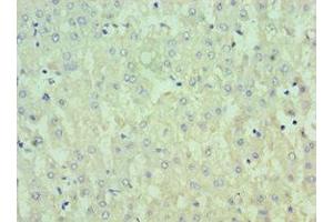 Immunohistochemistry of paraffin-embedded human liver tissue using ABIN7156797 at dilution of 1:100 (IL13RA2 antibody  (AA 27-343))