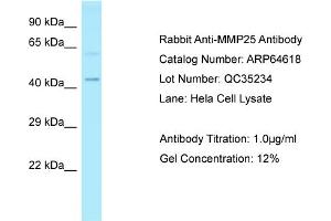 Western Blotting (WB) image for anti-Matrix Metallopeptidase 25 (MMP25) (Middle Region) antibody (ABIN2789901) (MMP25 antibody  (Middle Region))