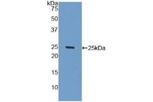 Detection of Recombinant GLb, Human using Polyclonal Antibody to Galactosidase Beta (GLb) (GLB1 antibody  (AA 68-219))