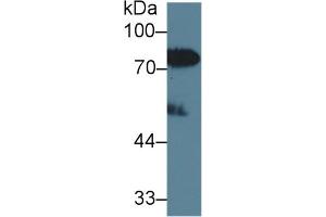 Western Blot; Sample: Human Serum; Primary Ab: 2µg/ml Rabbit Anti-Human LBP Antibody Second Ab: 0. (LBP antibody  (AA 27-481))