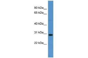 WB Suggested Anti-SPRED2  Antibody Titration: 0. (SPRED2 antibody  (C-Term))