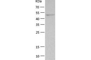 Thymidine Phosphorylase Protein (TYMP) (AA 11-482) (His tag)