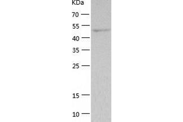 Thymidine Phosphorylase Protein (TYMP) (AA 11-482) (His tag)