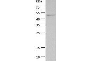Western Blotting (WB) image for Thymidine Phosphorylase (TYMP) (AA 11-482) protein (His tag) (ABIN7125385) (Thymidine Phosphorylase Protein (TYMP) (AA 11-482) (His tag))