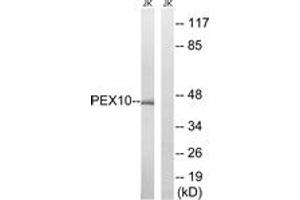 Western blot analysis of extracts from Jurkat cells, using PEX10 Antibody. (PEX10 antibody  (AA 183-232))
