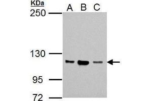 WB Image Sample (30 ug of whole cell lysate) A: Jurkat B: Raji C: K562 5% SDS PAGE antibody diluted at 1:1000 (Nucleolar Protein 1 (NOL1) (Internal Region) antibody)