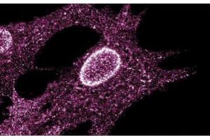 Immunofluorescent staining on Human Fibroblasts (LYN antibody  (AA 1-138))