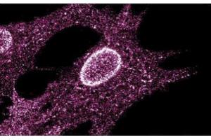Immunofluorescent staining on Human Fibroblasts (LYN antibody  (AA 1-138))