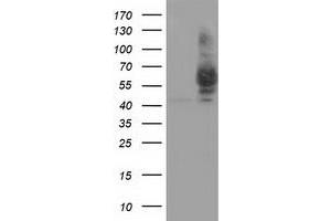 HEK293T cells were transfected with the pCMV6-ENTRY control (Left lane) or pCMV6-ENTRY PANK2 (Right lane) cDNA for 48 hrs and lysed. (PANK2 antibody)