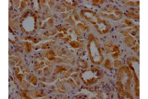 IHC image of ABIN7147846 diluted at 1:200 and staining in paraffin-embedded human kidney tissue performed on a Leica BondTM system. (Clathrin Heavy Chain (CLTC) (AA 851-990) antibody)