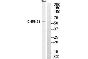 Western blot analysis of extracts from HeLa cells, using CHRNB1 antibody. (CHRNB1 antibody)