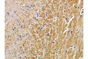 ABIN7094174 and ABIN7098219 at 1/100 staining rat brain tissue by IHC-P. (DNAJC21 antibody  (C-Term))