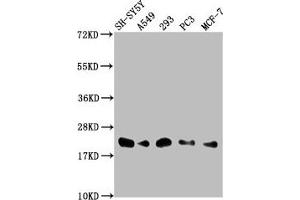Western Blot Positive WB detected in: SH-SY5Y whole cell lysate, A549 whole cell lysate, 293 whole cell lysate, PC-3 whole cell lysate, MCF-7 whole cell lysate All lanes: ITGB1BP1 antibody at 1:2000 Secondary Goat polyclonal to rabbit IgG at 1/50000 dilution Predicted band size: 22, 17 kDa Observed band size: 22 kDa (ITGB1BP1 antibody  (AA 1-200))