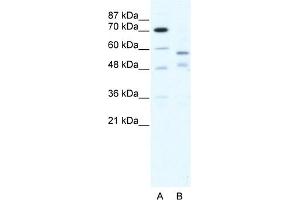 WB Suggested Anti-TRIM23 Antibody Titration:  5. (TRIM23 antibody  (C-Term))
