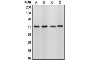 Western blot analysis of CUGBP1 expression in HL60 (A), HeLa (B), NIH3T3 (C), Sol8 (D) whole cell lysates.