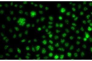 Immunofluorescence analysis of A549 cells using UBE2R2 Polyclonal Antibody (UBE2R2 antibody)
