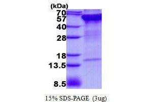 Figure annotation denotes ug of protein loaded and % gel used. (Ribophorin II Protein (RPN2))