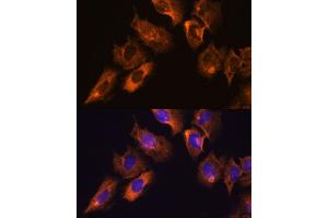 Immunofluorescence analysis of C6 cells using CAMKV antibody (ABIN7266051) at dilution of 1:100. (CAMKV antibody  (AA 1-285))