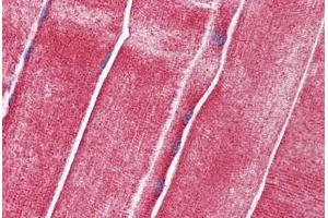 Human Skeletal Muscle: Formalin-Fixed, Paraffin-Embedded (FFPE) (SLC36A2 antibody  (AA 36-85))