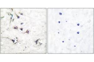Immunohistochemistry analysis of paraffin-embedded human brain tissue, using Ezrin Antibody.