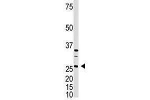 Image no. 1 for anti-Dickkopf Homolog 4 (Xenopus Laevis) (DKK4) (C-Term) antibody (ABIN357074) (DKK4 antibody  (C-Term))