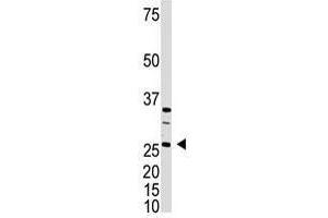Image no. 1 for anti-Dickkopf Homolog 4 (Xenopus Laevis) (DKK4) (C-Term) antibody (ABIN357074)