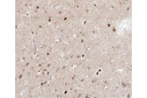 ABIN6266659 at 1/100 staining human brain tissue sections by IHC-P. (SENP7 antibody  (C-Term))