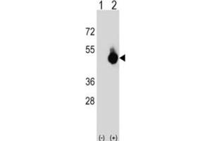 Western Blotting (WB) image for anti-G Patch Domain and Ankyrin Repeats 1 (GPANK1) antibody (ABIN3003885)