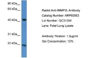 WB Suggested Anti-IMMP2L  Antibody Titration: 0. (IMMP2L antibody  (C-Term))
