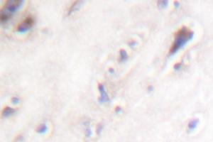 Image no. 2 for anti-Islet Amyloid Polypeptide (IAPP) antibody (ABIN271869) (Amylin/DAP antibody)