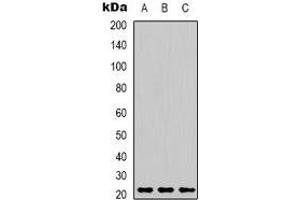 Western blot analysis of Peroxiredoxin 1 expression in MCF7 (A), mouse brain (B), rat kidney (C) whole cell lysates.