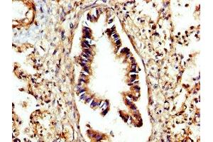 IHC image of ABIN7149978 diluted at 1:300 and staining in paraffin-embedded human lung tissue performed on a Leica BondTM system. (CTSC antibody  (AA 25-134))