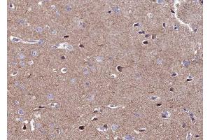 ABIN6269408 at 1/100 staining human brain tissue sections by IHC-P. (CaMK2 alpha/delta antibody)