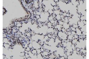 ABIN6277979 at 1/100 staining Mouse lung tissue by IHC-P.
